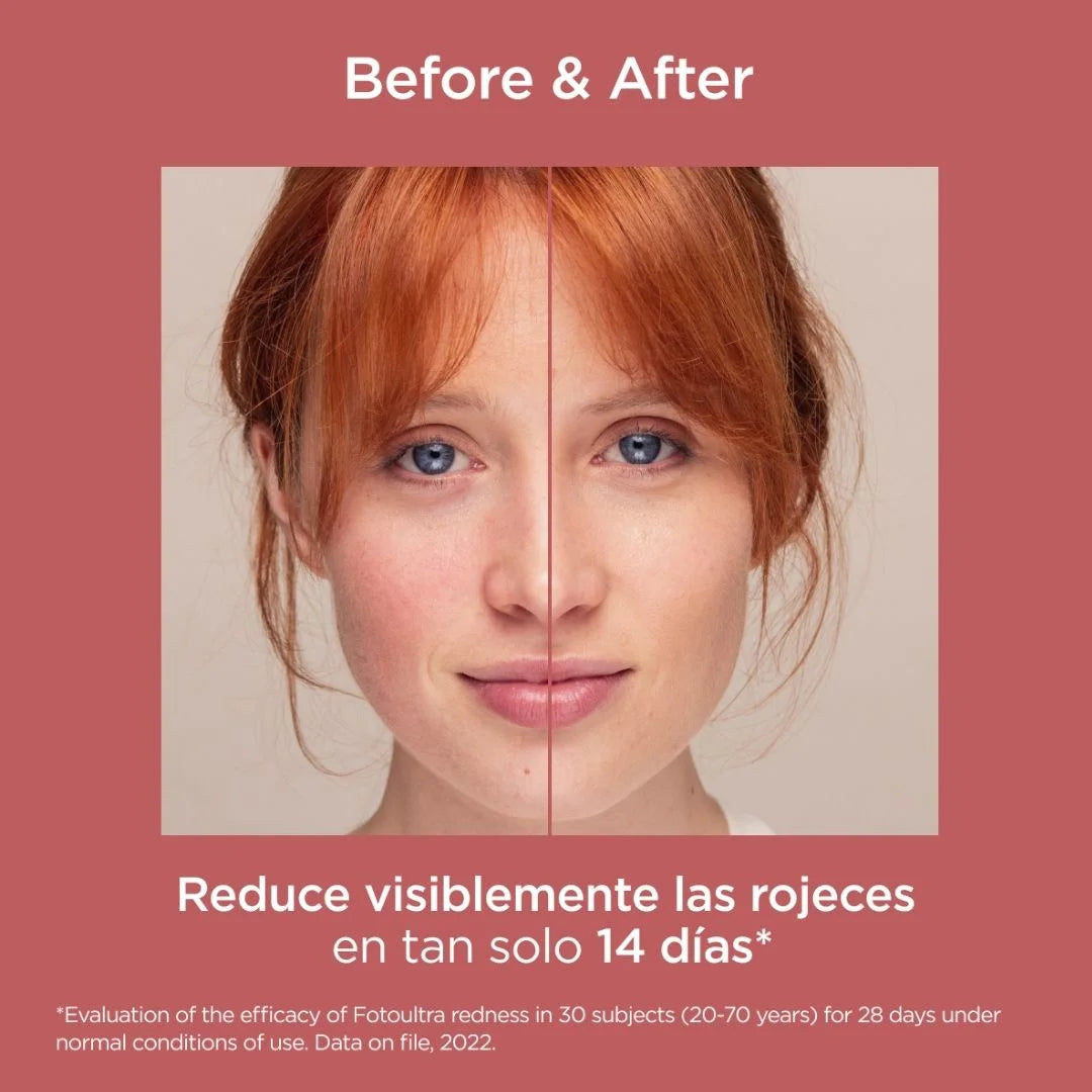 ISDIN - FOTOULTRA REDNESS SPF50