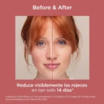 ISDIN - FOTOULTRA REDNESS SPF50 - Imagen 2